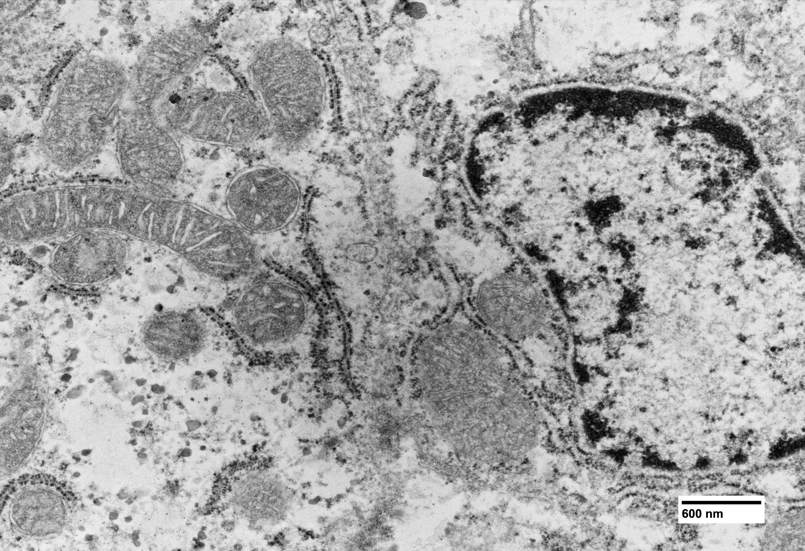 imgi_12_9-e-10-–-Mitochondria-from-the-fish-species-Astronotus-ocellatus-diffused-by-perinuclear-region-scaled