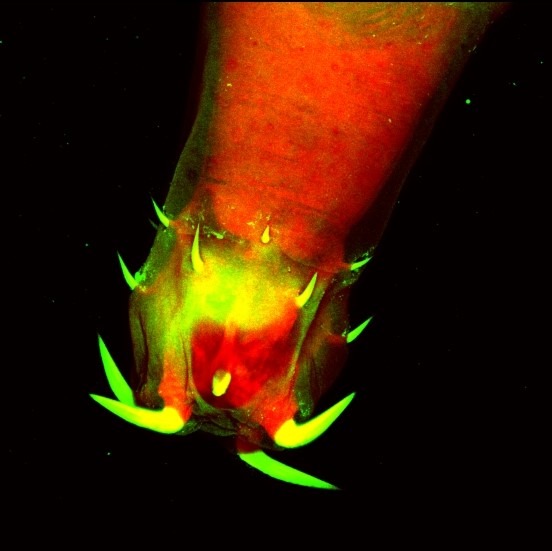 imgi_3_12-Acanthocephala-Neoechinorhynchus-buttnerae