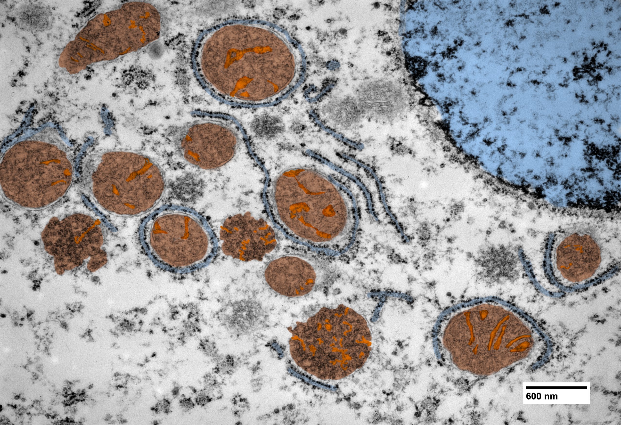 imgi_4_9-e-10-–Mitochondria-from-the-fish-species-Astronotus-ocellatus-diffused-by-perinuclear.2region-scaled